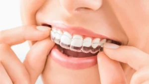 Mooresville Invisalign