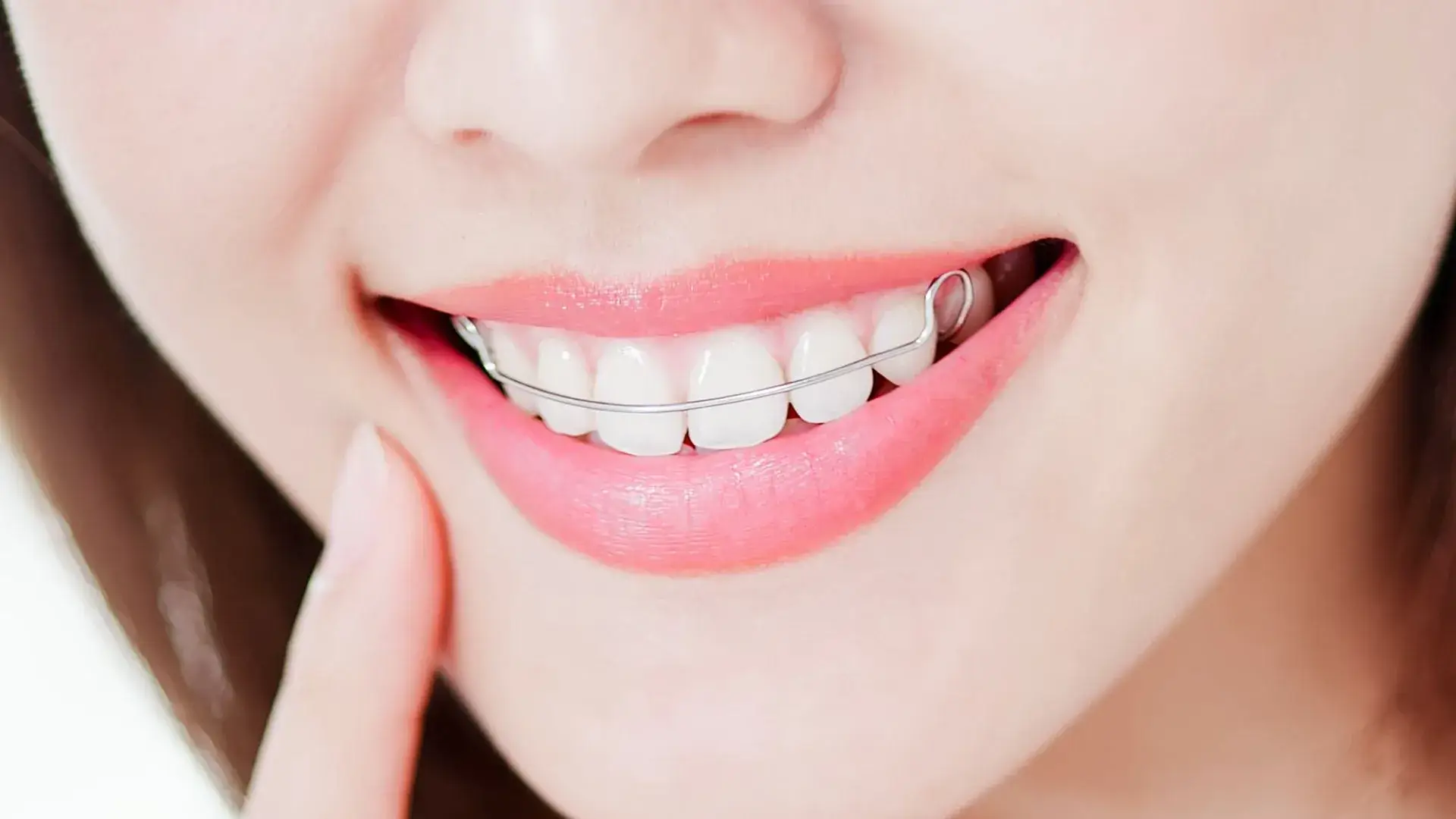 Mooresville Retainers