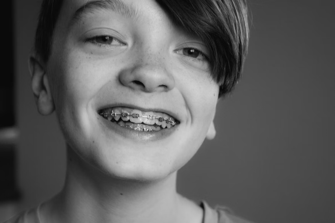 black and white photo of a boy smiling, showing his teeth with braces