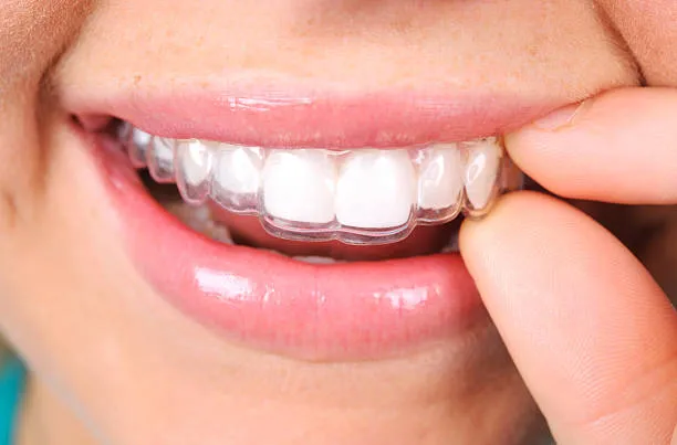 phot of a woman removing her Invisalign