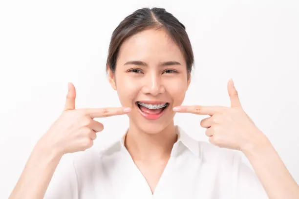 a woman smiling widely while pointing to her dental braces