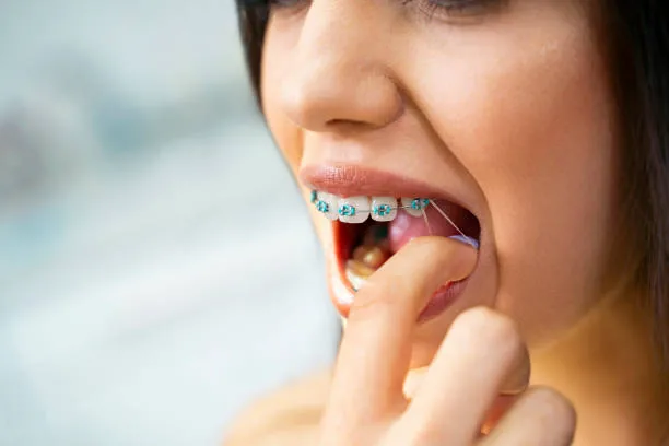 a woman pulling her braces elastics