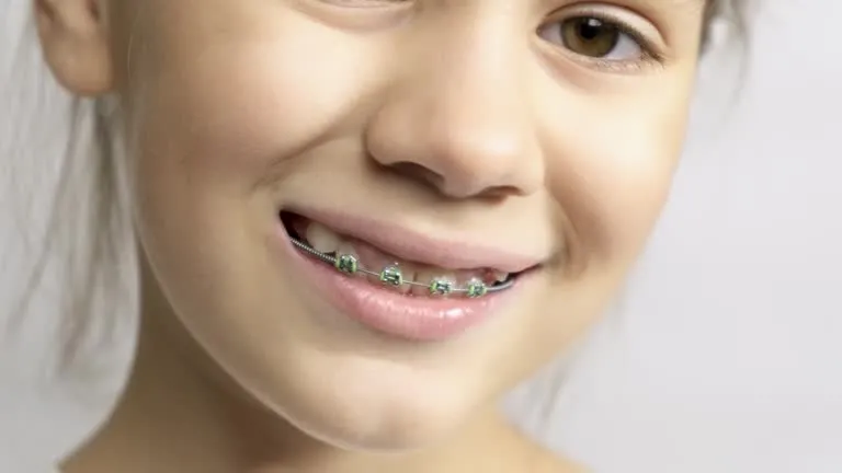 close-up shot of a kid with braces