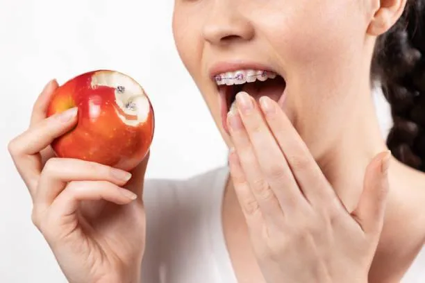 shocked woman with braces shows red apple with lost brackets locks